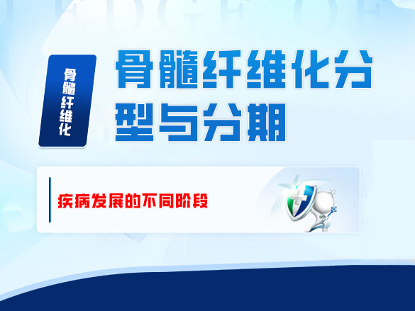 骨髓纤维化分型与分期——疾病发展的不同阶段 